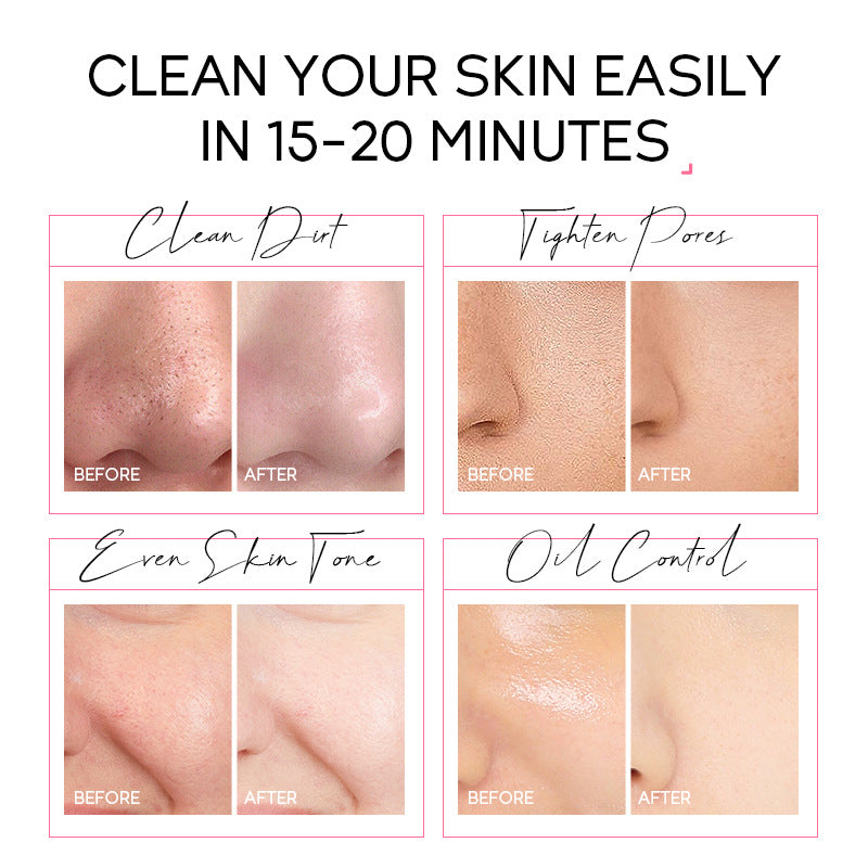 Nexora Petal Peel-Off Pore Mask